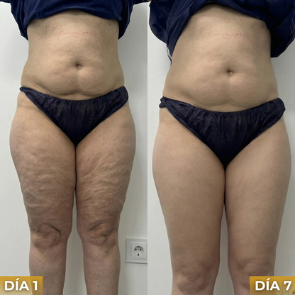 Veltrix™ Aceite Intensivo Anticelulitis Reafirmante