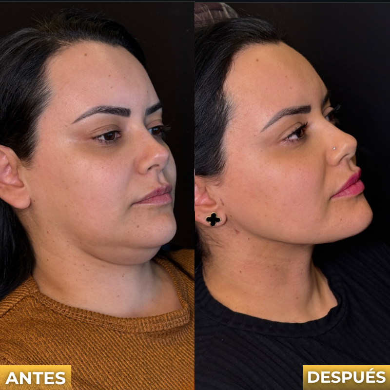 Veltrix™ Crema Reafirmante Para El Cuello