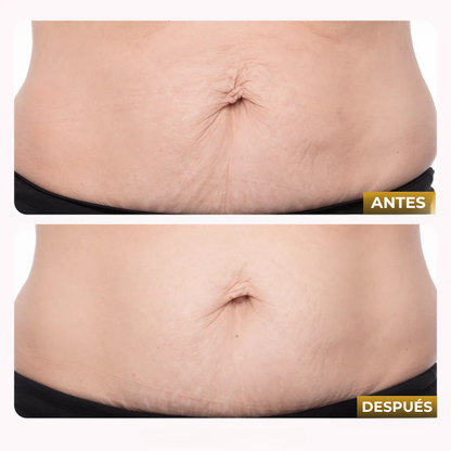 Veltrix™ Aceite Intensivo Reafirmante